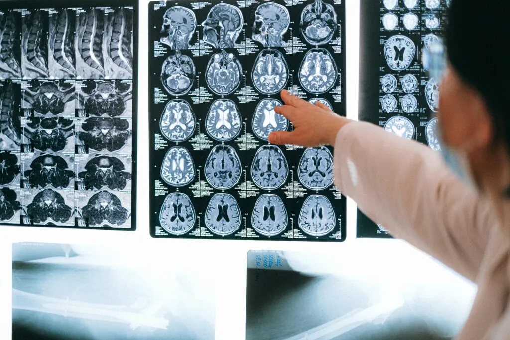 Cómo el omega-3 Ayuda a Desinflamar el Vientre (Eje intestino-cerebro)